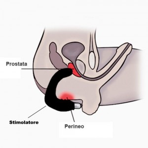 Tentacular Tease Prostate... 2